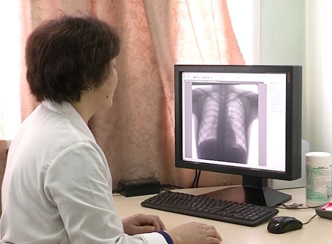 В Улан-Удэ больного туберкулезом силой заставили лечиться