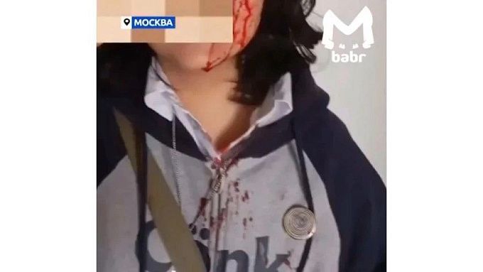 14-летнюю школьницу из Бурятии избили в Москве