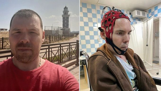 Бытовой несчастный случай приковал пенсионера МВД из Улан-Удэ к постели. Семья просит о помощи 
