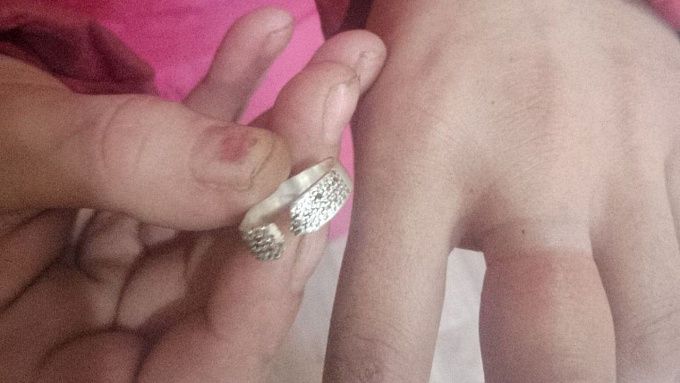 В Бурятии пожарные помогли женщине снять кольцо с пальца
