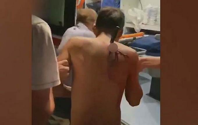 В Бурятии врачи сообщили о состоянии мужчины, получившего нож в спину