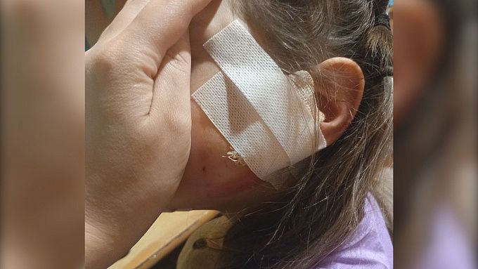 Собака покусала 7-летнего ребенка в центре Улан-Удэ