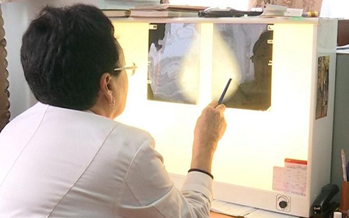 В России стремительно молодеет рак груди