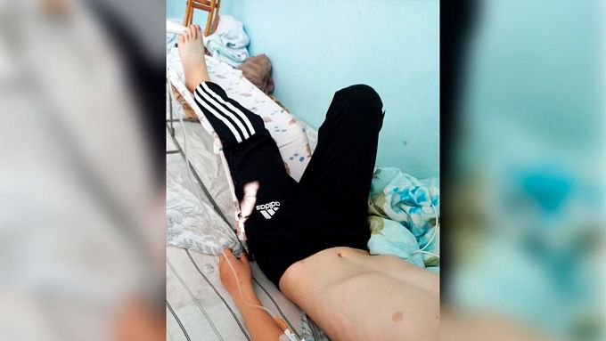 В Бурятии врачи спасли 10-летнего мальчика после укуса змеи