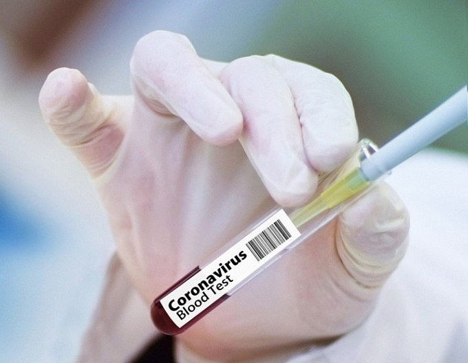 Число случаев коронавируса в Бурятии перевалило за 4 тысячи
