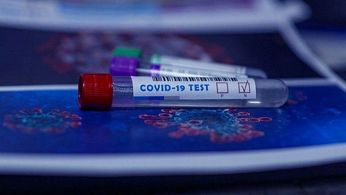 В Бурятии за сутки выявили 66 заразившихся коронавирусом