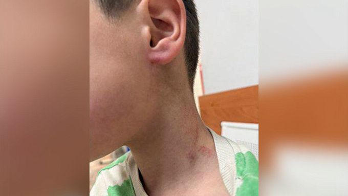  Схватил за шею и оттаскал за уши: тренер детского сада в Иркутской области побил воспитанника