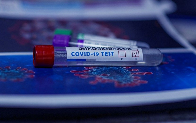 В Бурятии за сутки зафиксировали 23 случая заражения коронавирусом