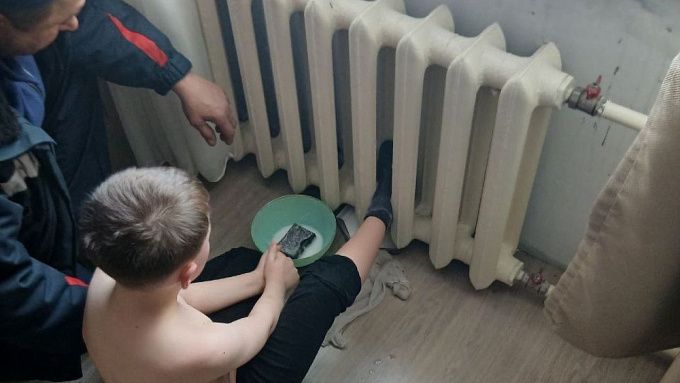 В Улан-Удэ нога 7-летнего мальчика застряла в горячей батарее