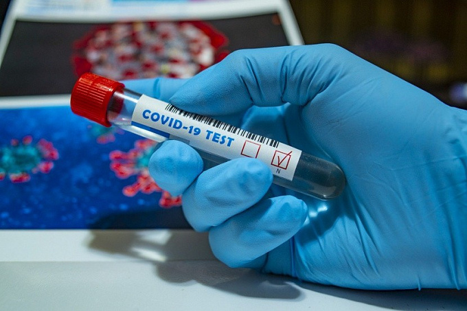 В Бурятии за сутки коронавирусом заразились еще 48 человек
