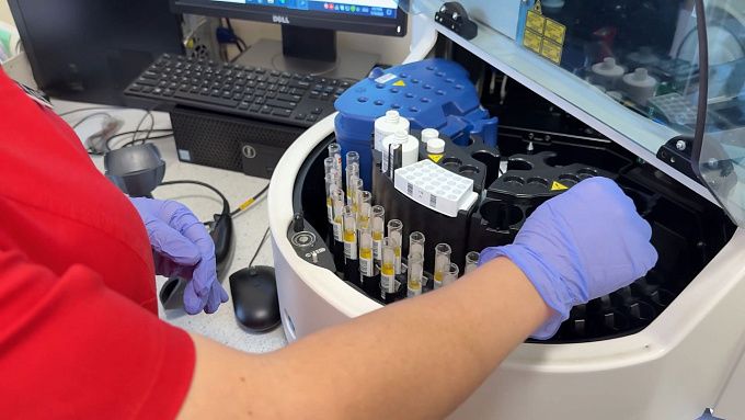 Новый способ ускорить заживление ран обнаружили в Бурятии