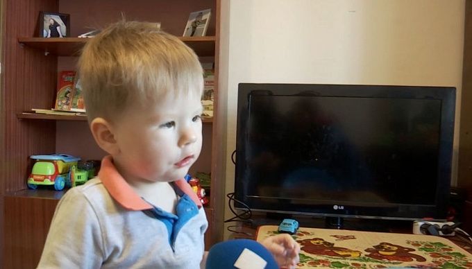В Бурятии ребенок с синдромом Мебиуса снова нуждается в помощи