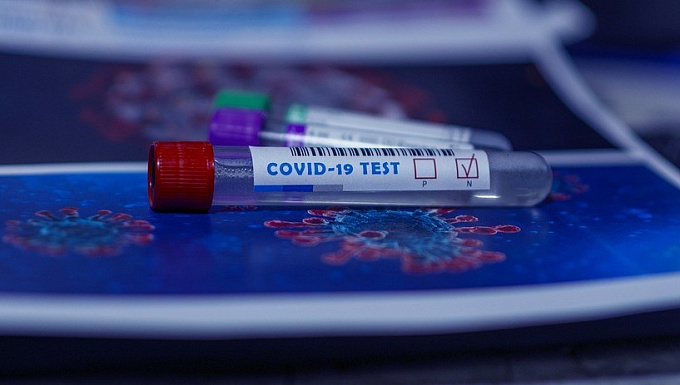 В Бурятии за сутки коронавирусом заразились 64 человека, выздоровели - 37